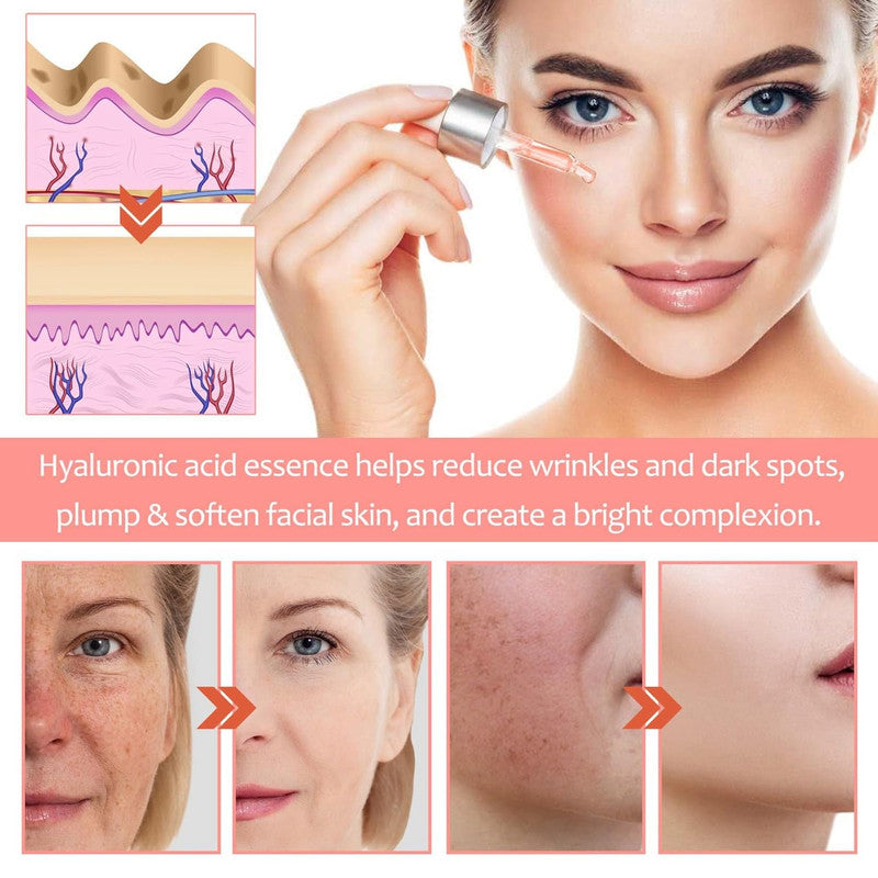 5 In 1 Anti Aging Vitamin C Face Serum with Hyaluronic Acid & Collagen – Firming, Moisturizing & Brightening